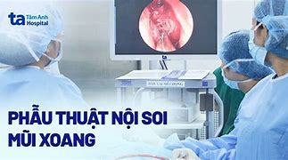 Nội Soi Qua Mũi